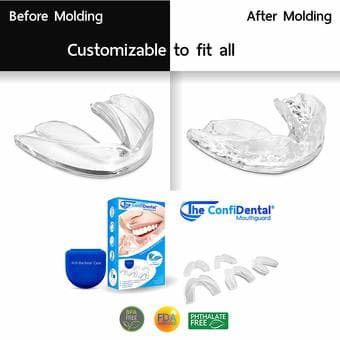 moldable mouth guards for teeth grinding, contact sports 1