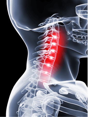 Participate in a Stanford Chronic Pain Study and Receive $200 Cash 3
